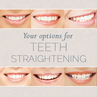 Fort Wayne dentist, Dr. David Diehl and and Dr. Allyson Feasel at Dupont Family Dentistry shares all you need to know about choosing the right teeth straightening option for you.