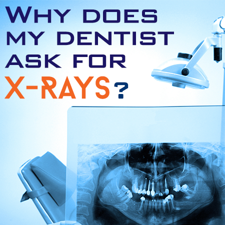 x_rays